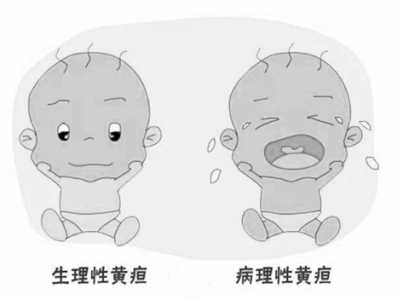 如何区分生理性和病理性新生儿黄...